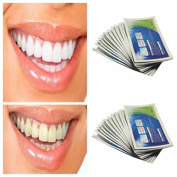 Clareamento dental